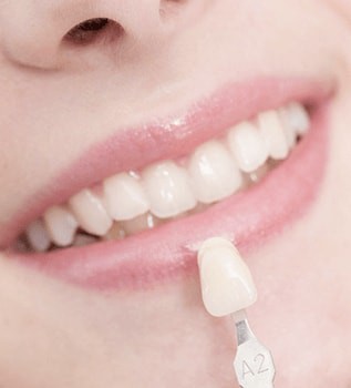 Implants & Implants Related Services